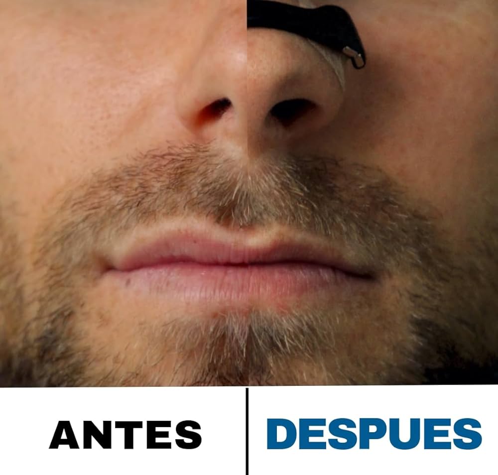 SILENT PRO - ÚLTIMA TECNOLOGÍA ANTI RONQUIDOS 🌬️