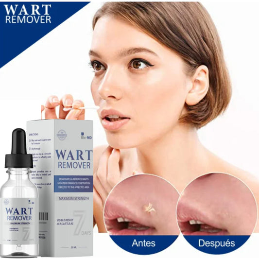WART REMOVER - REMOVEDOR DE VERRUGAS Y ARRUGAS INSTANTANEO